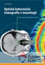 Optická koherenční tomografie v neuro...